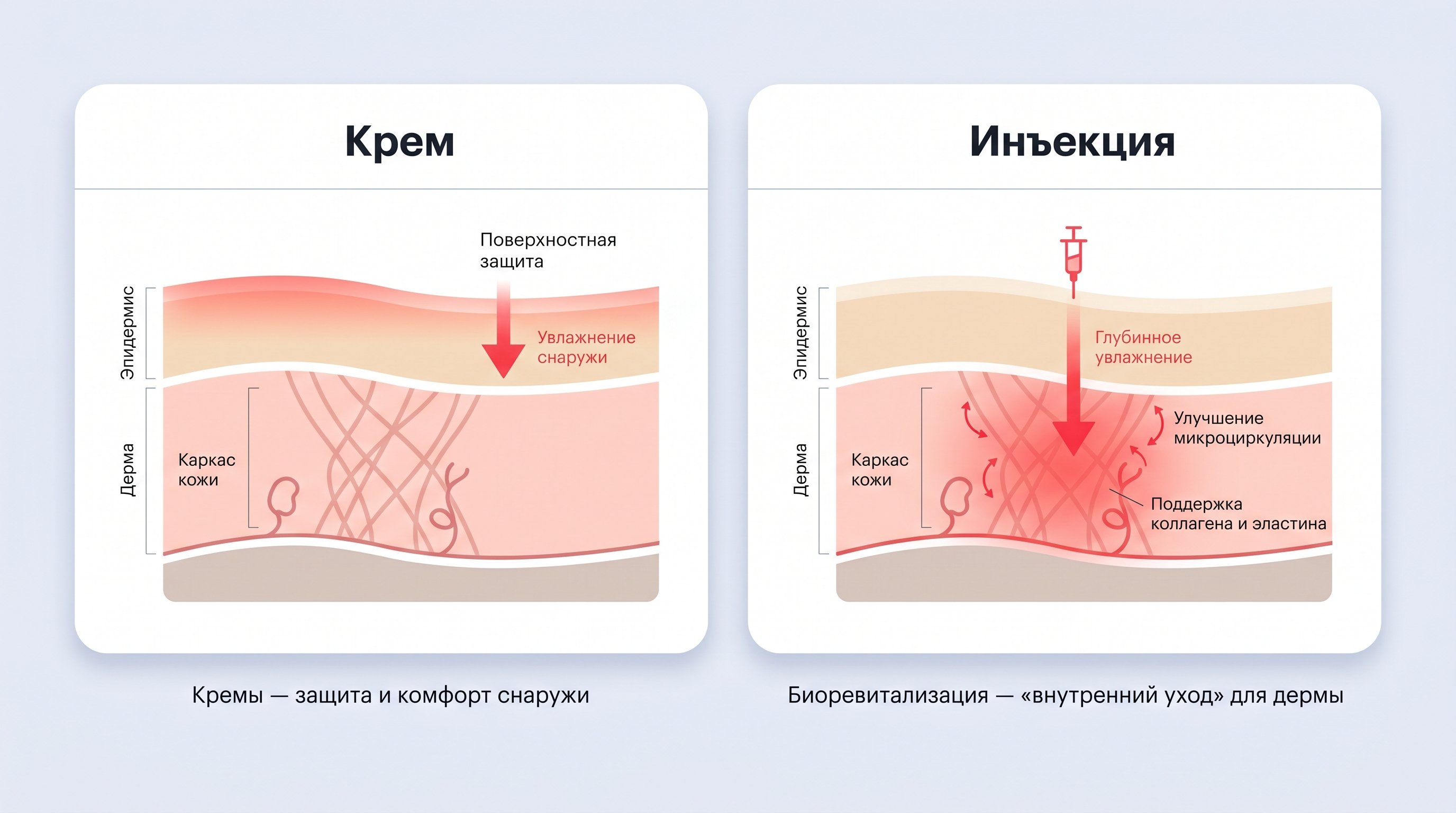 Горизонтальное сравнение двух упрощённых разрезов кожи: слева — блок «Крем», справа — блок «Инъекция». В каждом блоке показаны слои кожи и стрелки, демонстрирующие, до какого