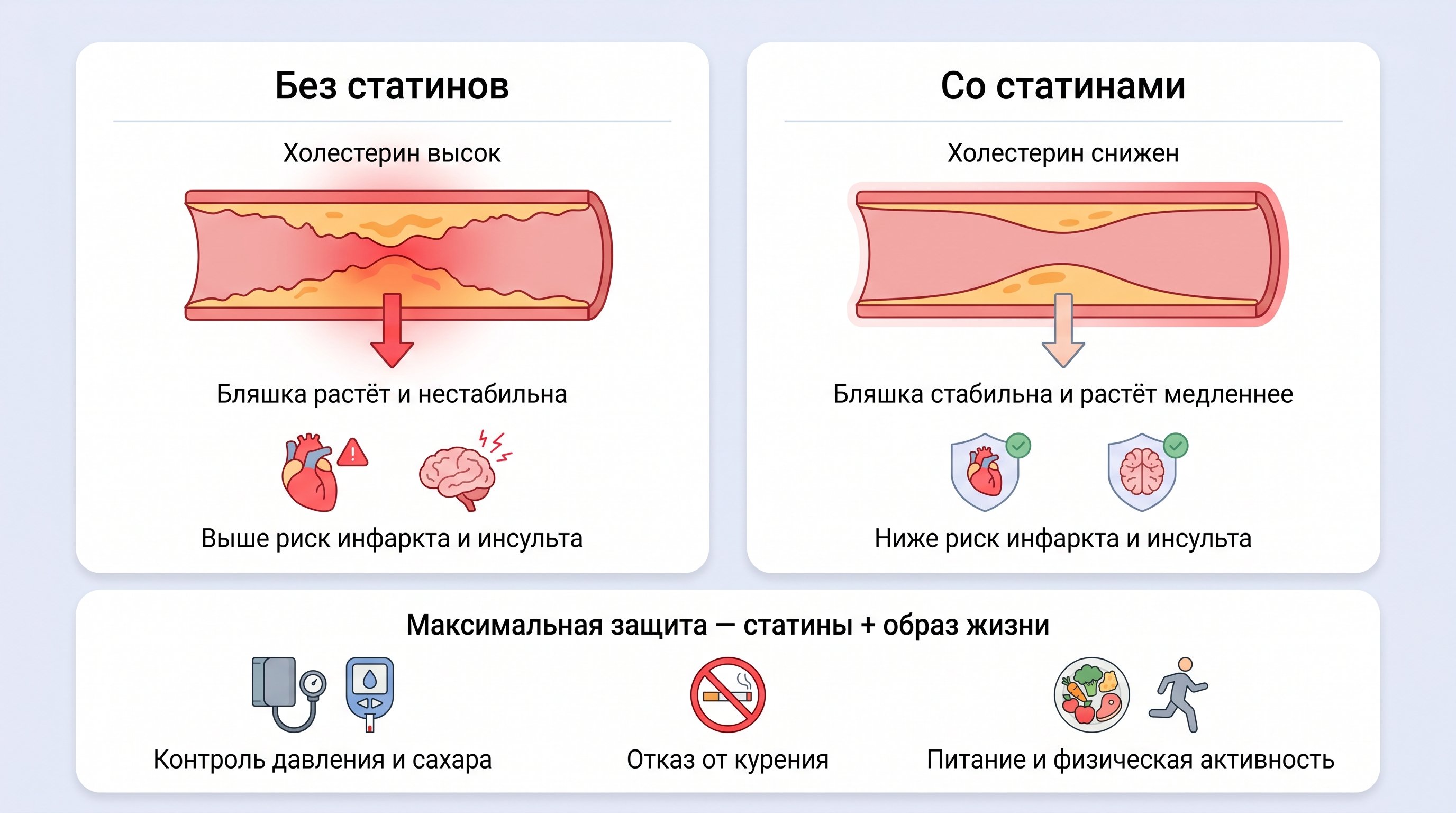 Вертикальная инфографика с двумя основными блоками: слева «без статинов» условная артерия с нарастающей бляшкой и стрелкой к иконкам инфаркта/инсульта, справа «со статинами» —