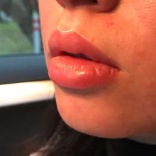 Перманентный макияж губ, в технике Натурель, полное заполнение цветом, выравнивание формы. 