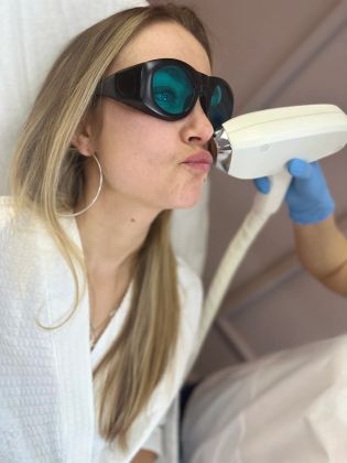 Удаление пускового волоса над губой .