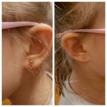 Прокол ушей (малышка 4 года)