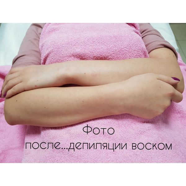 Депиляция рук