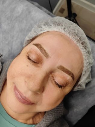 После заживления цвет и форма станут более мягкими