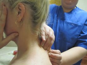 На фото показано как от процедуры к процедуре при помощи сочетания процедур (УЗ-кавитация, ручной массаж и rf-лифтинг происходит избавление клиентки от холки.