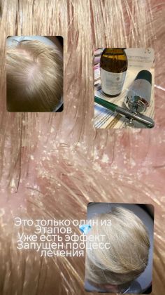 Молекулярное Востановление Волос 
Холодная реконструкция волос 
Лечение кожи головы волос 
Наращивание волос , загущение 

