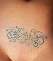 Удаление татуировок лазером в Перми - цены, отзывы | БьютиМед