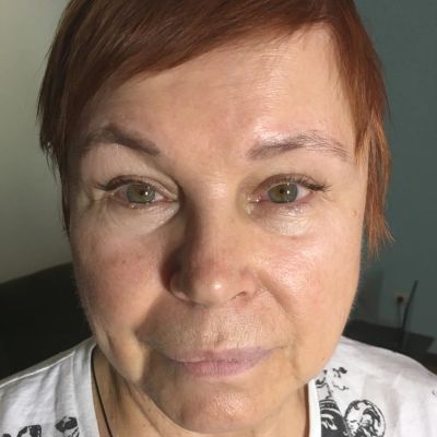 Наращивание уголки