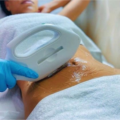 Лазерная диодная эпиляция живот