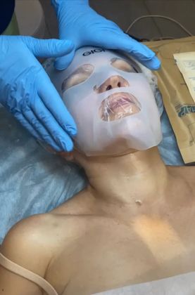 Косметологическая процедура лица в клинике красоты, профессионально и безопасно.