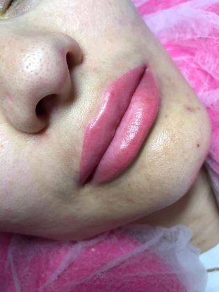 Перманентный макияж губ в акварельной технике сразу после процедуры 