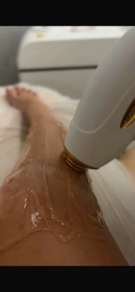 Лазерная эпиляция ног — это удаление волос по всей длине ноги от лодыжки до верхней части бедра. Она ограничена линией бикини и включает в себя лазерную эпиляцию:
голени;
коленей;
бёдер.
Лазерная эпиляция — это процедура, основанная на использовании энергии света, излучаемой лазером.