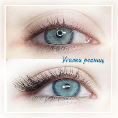 Уголки ресниц