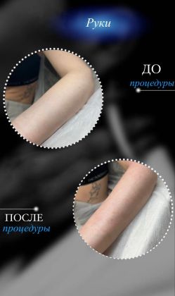 Время работы 20 минут , цена 690 рублей 