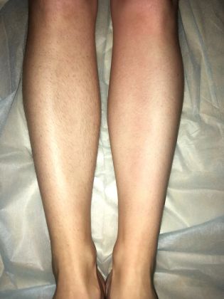 Ноги полностью , слева -до работы , справа - после 