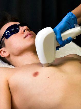 Мужская эпиляция