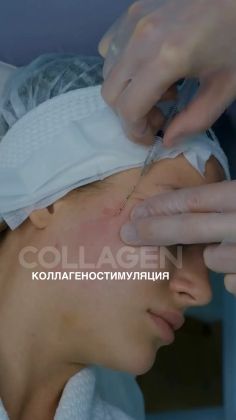 Косметолог проводит уход за кожей лица