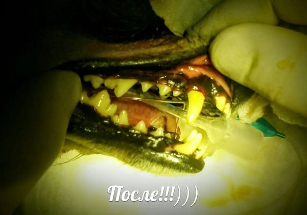 После Ультрозвуковой чистки зубов под анестезией.