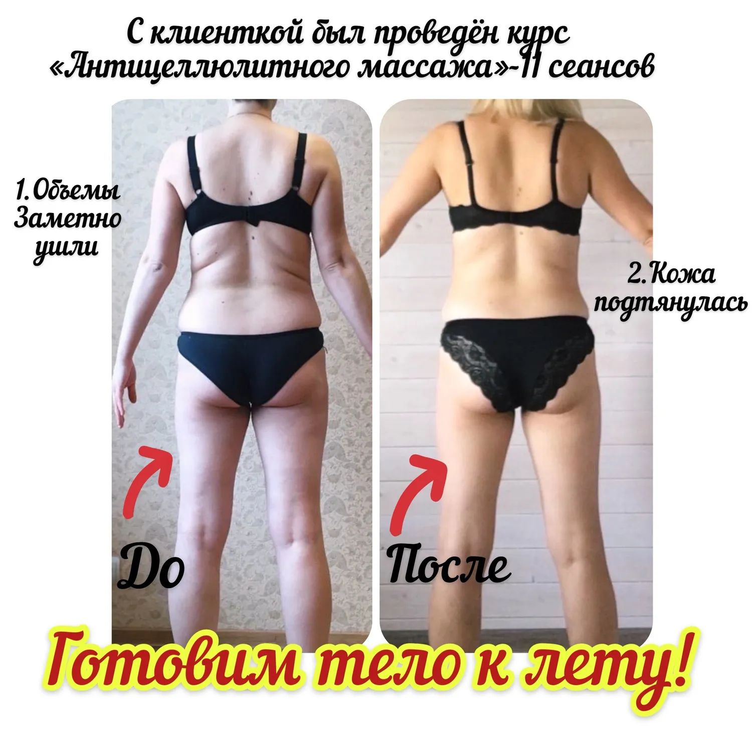 Фотографии лимфодренажного массажа из портфолио специалистов на Профи.  Страница 1