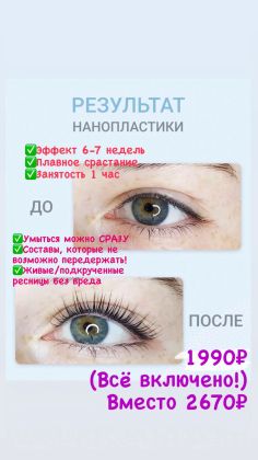 

КОМПЛЕКС НАНОПЛАСТИКА ИЛИ СТРЕЙЧИНГ 