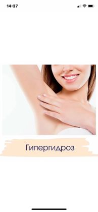 Гипергидроз подмышек -на 2 й день уже начинается ощущения сухости. Эффект на 6-10 месяцев 