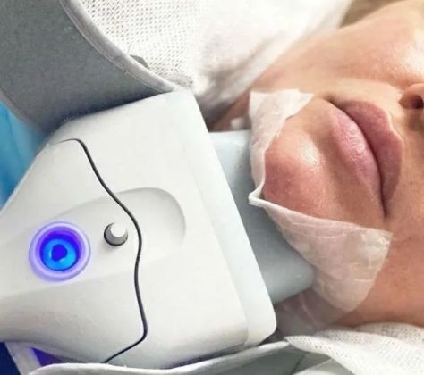 Криолиполиз 