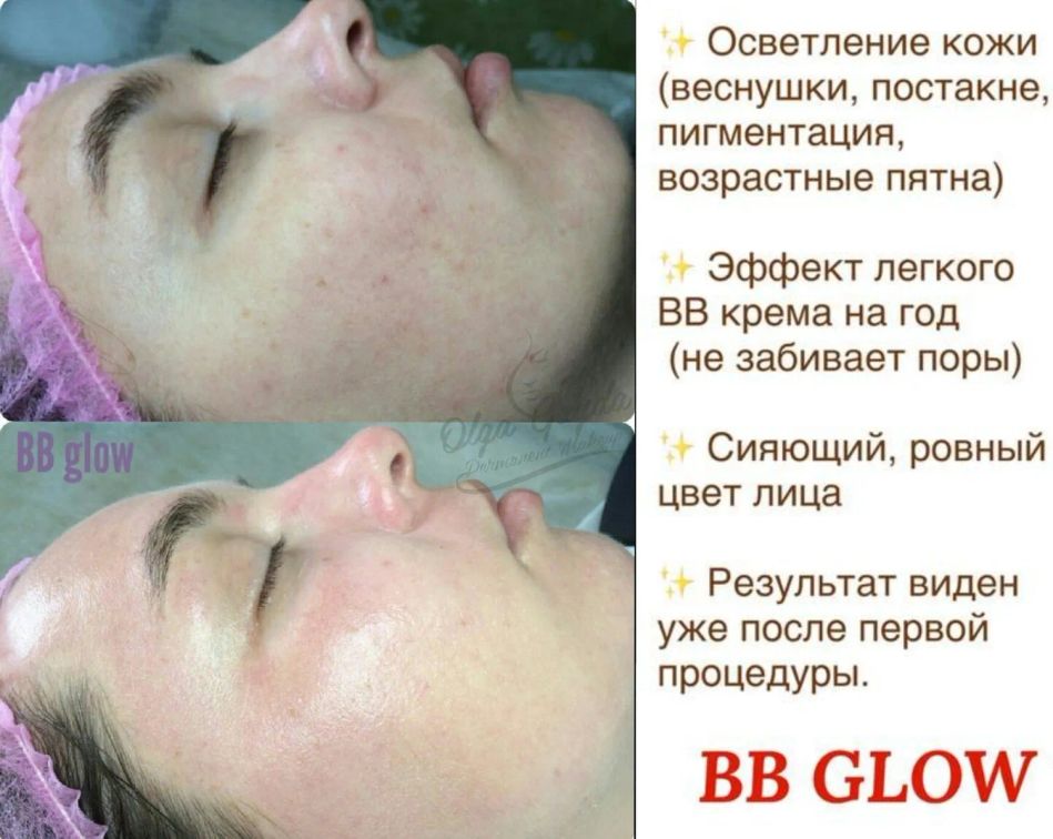 Получение идеальной кожи без использования тонального крема с помощью процедуры BB Glow: секреты и рекомендации