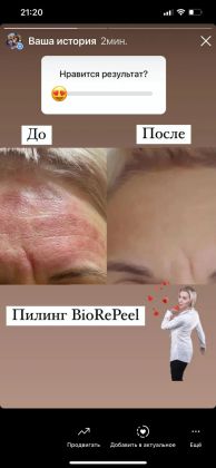 Микронидлинг по пилингу BioRePeelCl3