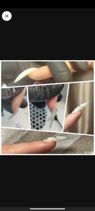 Ремонт ноготка- поднятие клюющего ноготка