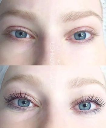 Ламинирование