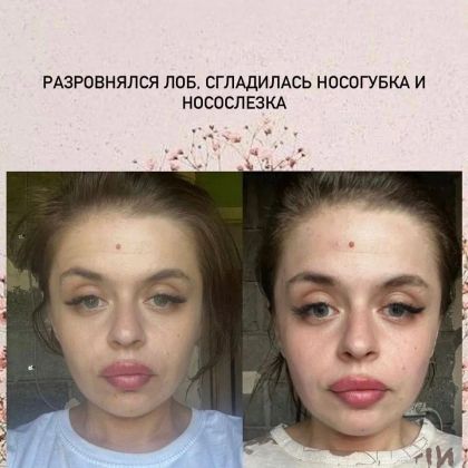 Результат после одного сеанса