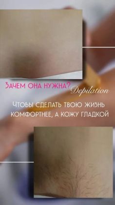 Эпиляция: безопасное удаление волос с кожи с помощью воска.