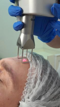 Профессиональная косметологическая процедура для лица: улучшение кожи