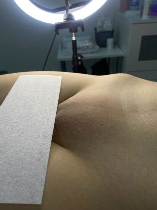 Глубокое бикини