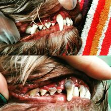 Ультразвуковая чистка зубов без наркоза
