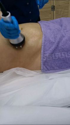 Процедура косметологической чистки лица с использованием аппаратной техники.