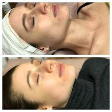 Уходовая процедура по восстановлению кожи + массаж лица 