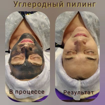 Два флакона косметического средства для ухода за кожей лица