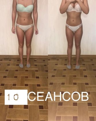 Фото до/ после , 10 сеансов антицеллюлитного медового массажа 