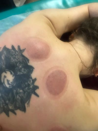 Задействует лимфу,улучшает кровоток в верхних слоях эпидермиса ,улучшает общее самочувствие 