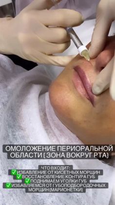 Заполнение мелки морщин