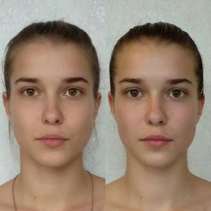 Результаты До/После косметического массажа лица + альгинатная маска