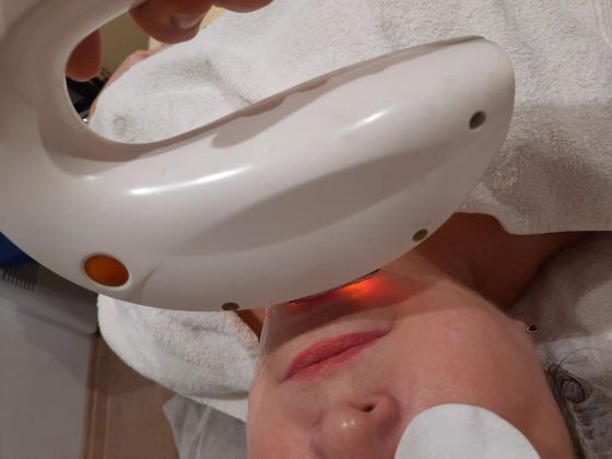 Элос эпиляция